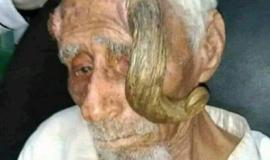 وفاة المعمر اليمني (ذو القرنين) عن عمر يناهز 140 عاما