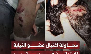 محاولة اغتيال عضو النيابة الابتدائية بمديرية يافع رصد