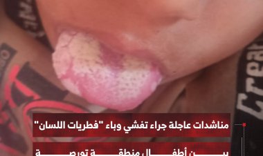 مناشدات عاجلة جراء تفشي وباء "فطريات اللسان"   بين أطفال منطقة تورصة